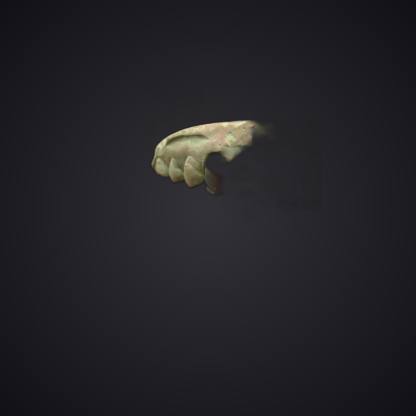 RockStar Silver Cap Grillz