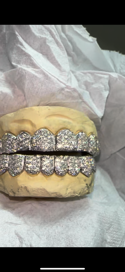 Full Bust Down Moissanite HoneyComb Style Diamond Grillz