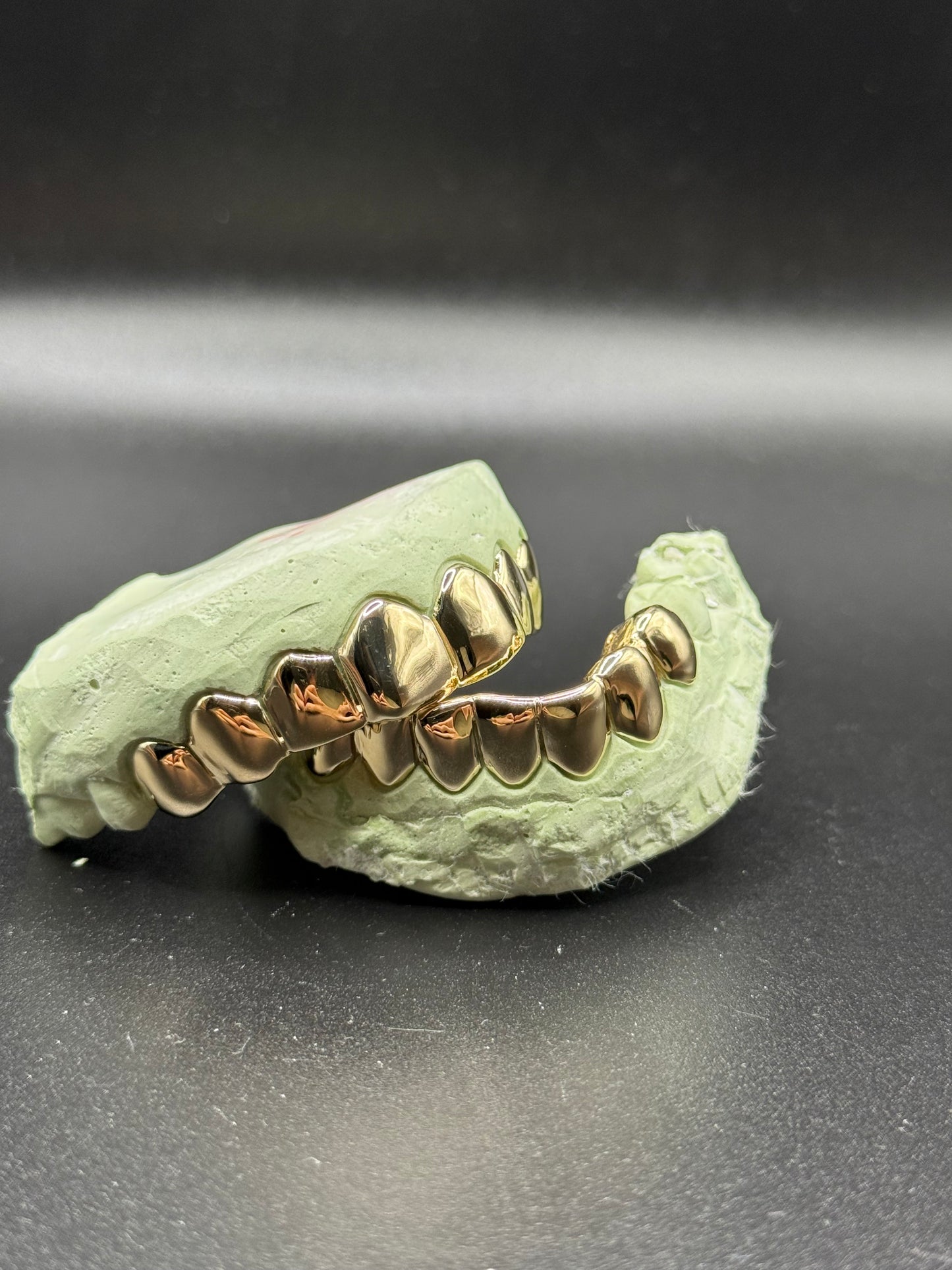 Custom Solid Gold Grillz