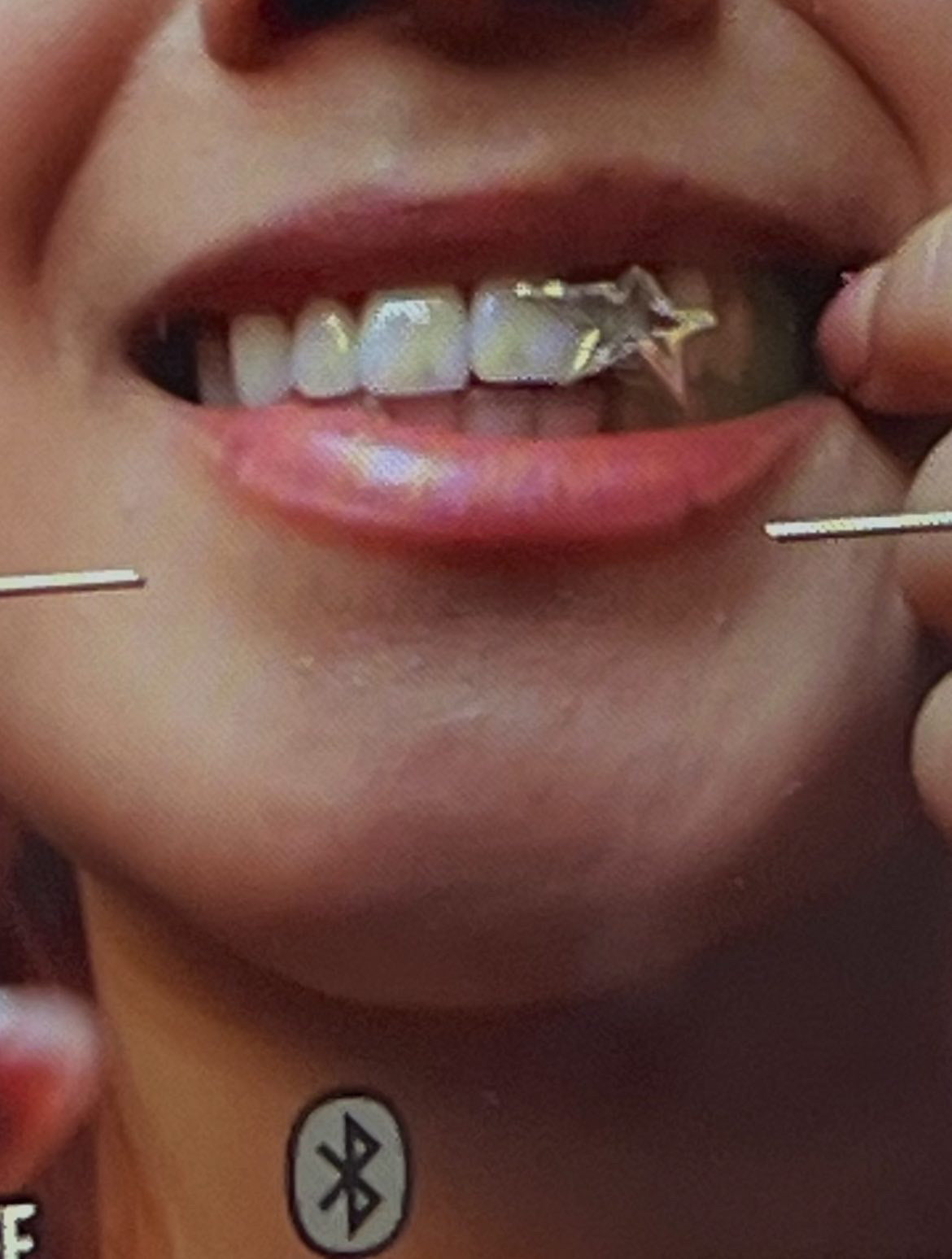 RockStar Silver Cap Grillz