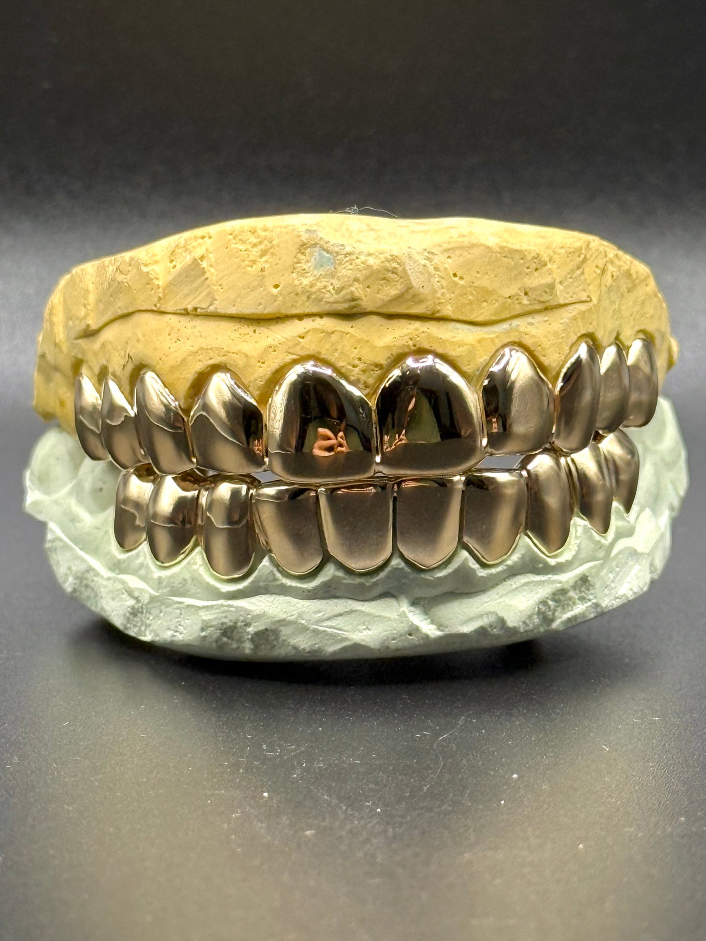 Custom Solid Gold Grillz