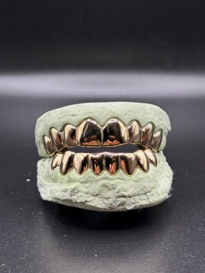 Custom Solid Gold Grillz