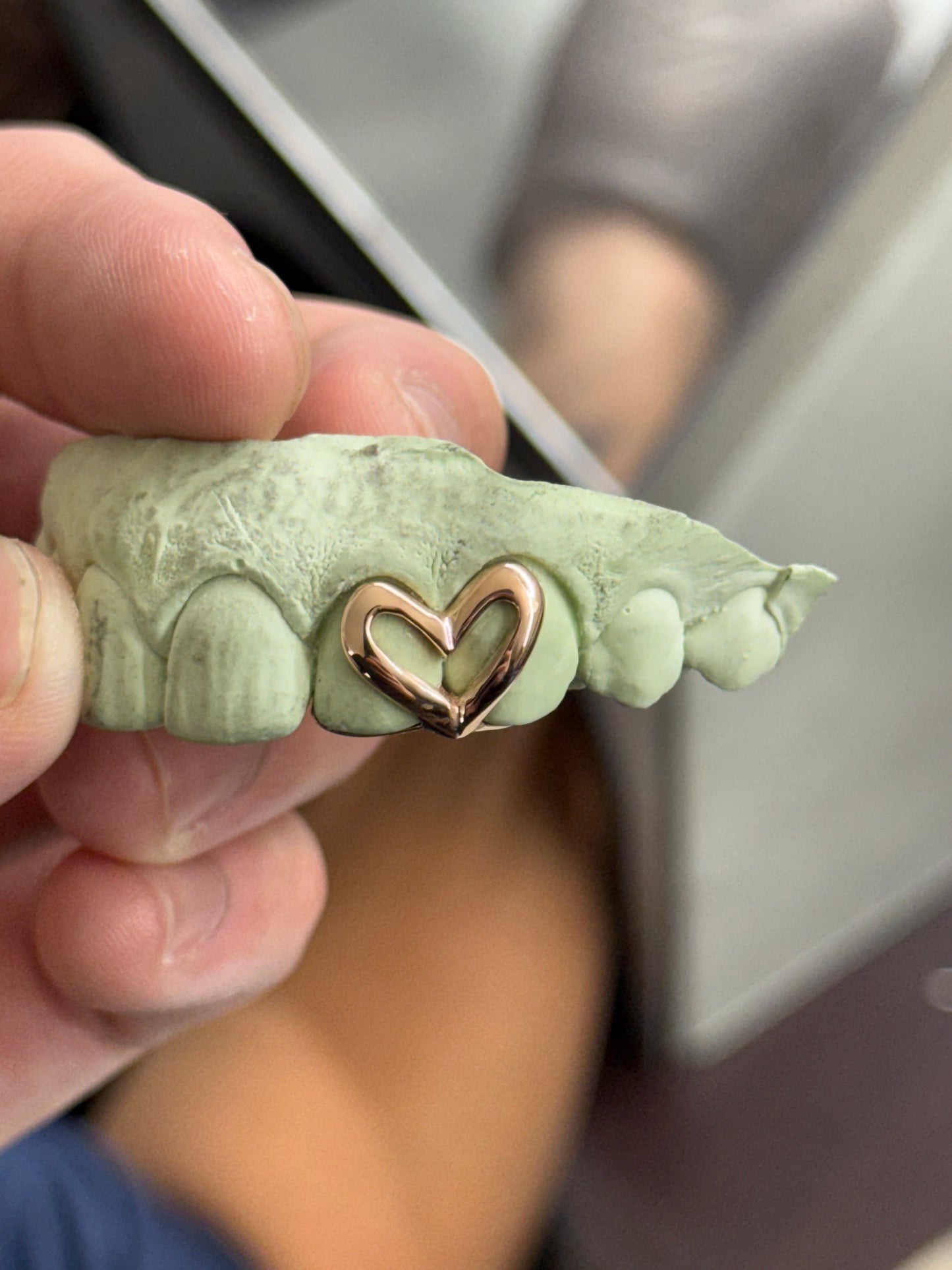 Custom Open Heart Open Face Grillz