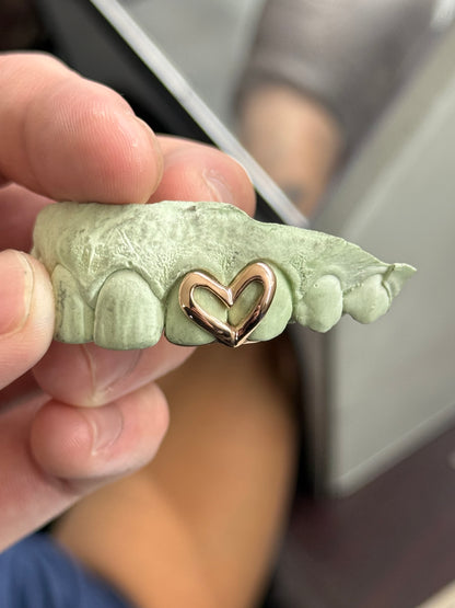 Custom Open Heart Open Face Grillz