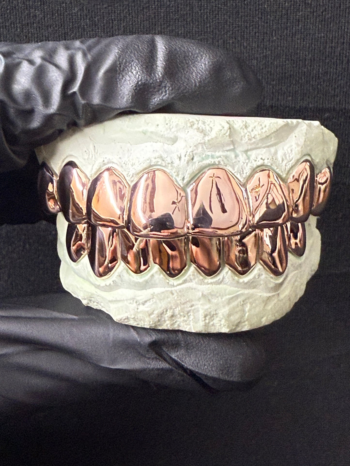 Custom Solid Gold Grillz