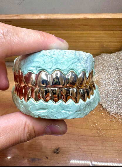 Custom Solid Gold Grillz