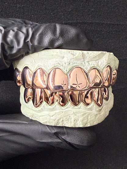 Custom Solid Gold Grillz