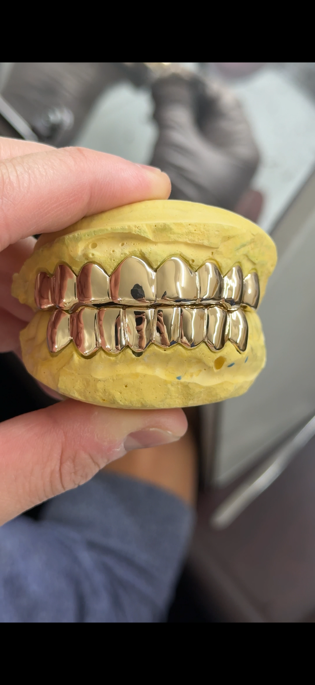 Custom Solid Gold Grillz