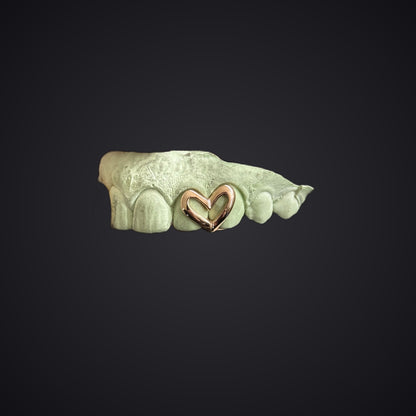 Custom Open Heart Open Face Grillz