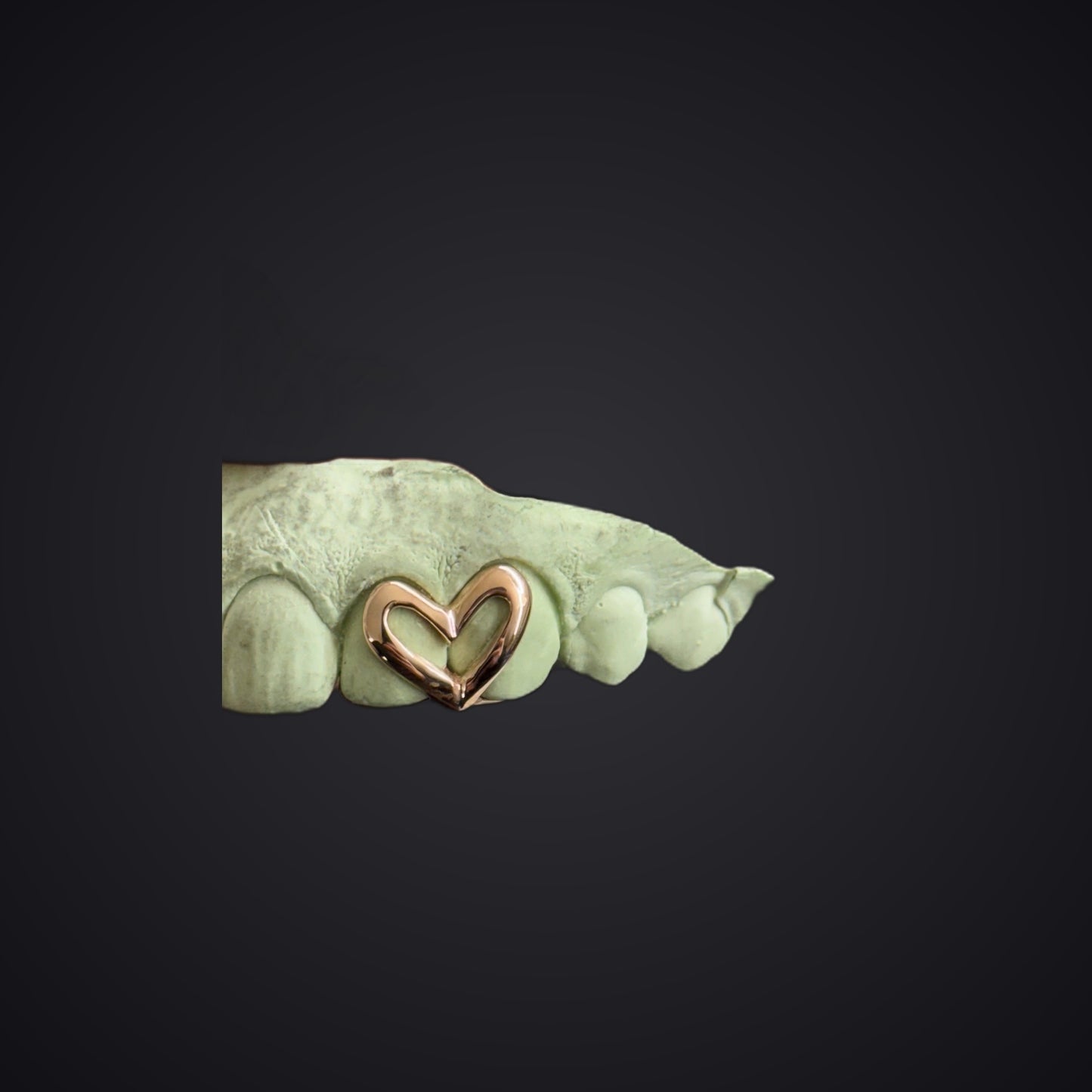 Custom Open Heart Open Face Grillz