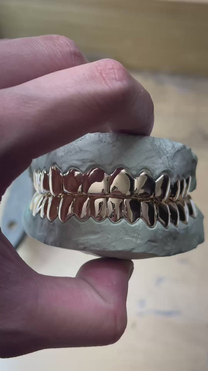 Custom Solid Gold Grillz