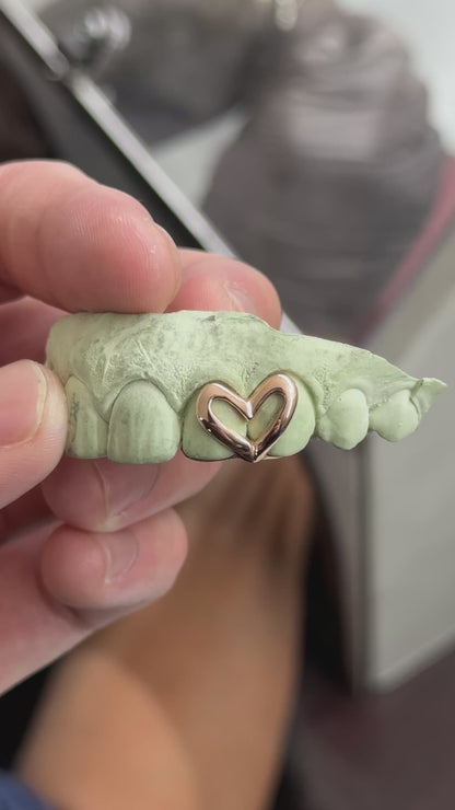 Custom Open Heart Open Face Grillz